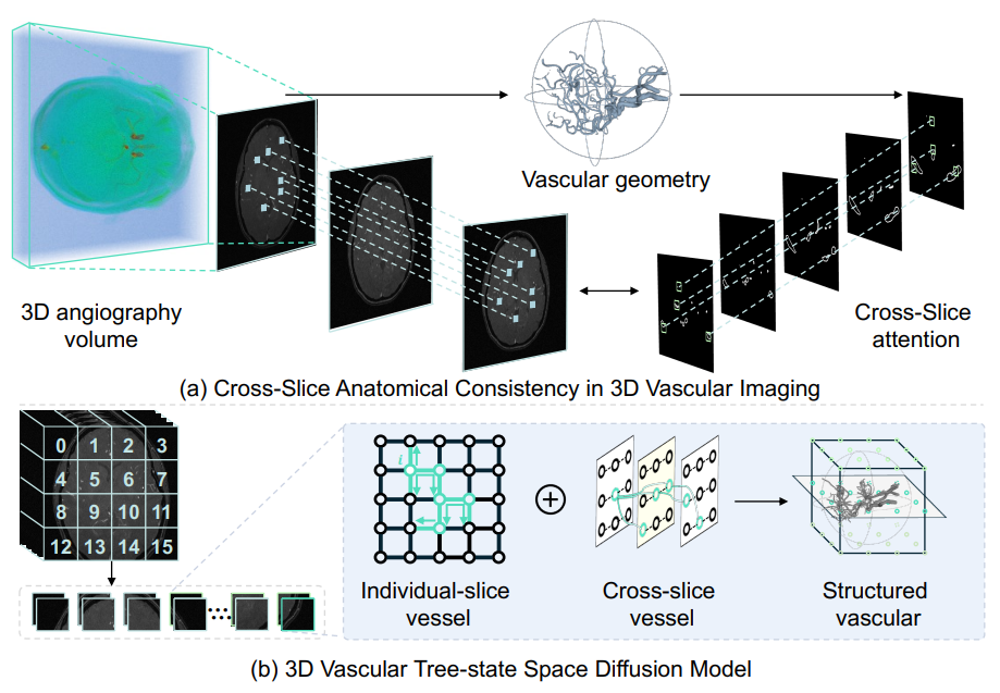 VasTSD: Learning 3D Vascular Tree-state Space Diffusion Model for Angiography Synthesis